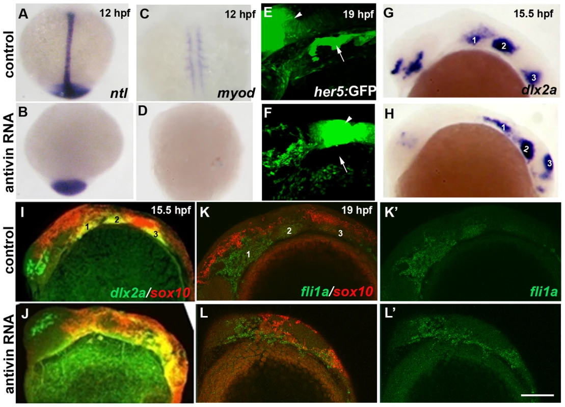 Mesoderm and endoderm are not essential for ectomesenchyme formation.