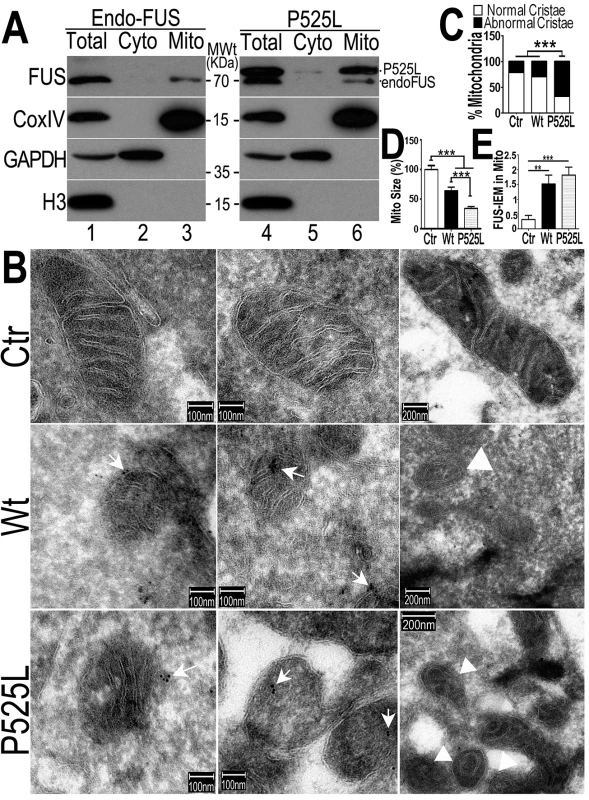 The FUS protein is associated with mitochondria.