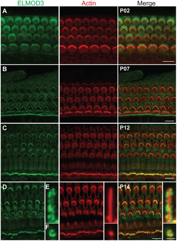 ELMOD3 is expressed in sensory cells of rat organ of Corti.