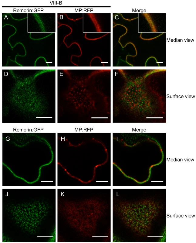 Inactivation of myosin VIII causes patchy accumulation of MP at the PM.