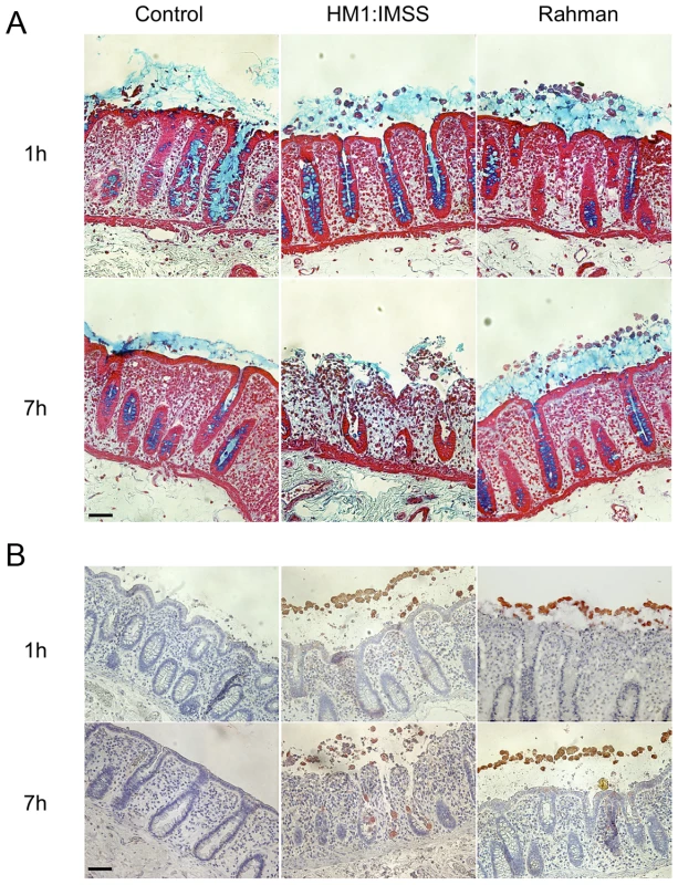 Human colon explants incubated with <i>E. histolytica</i> HM1:IMSS or Rahman trophozoites.