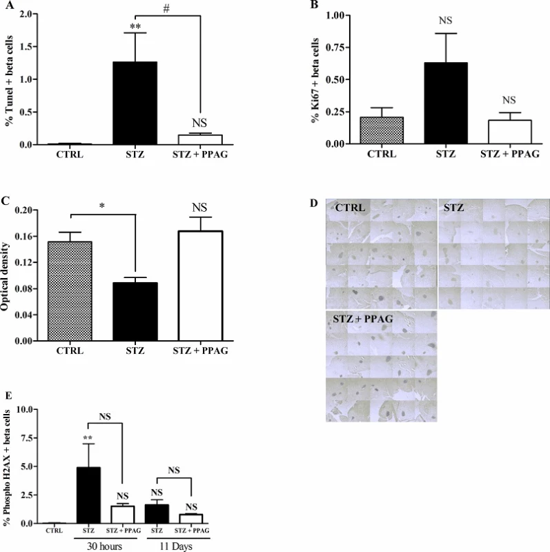 Effect of STZ and PPAG on beta cell apoptosis/proliferation and the expression of BCL2 and phospho H2AX. Shaded bars: untreated controls, CTRL (n = 5); filled bars: STZ-treated animals, STZ (n = 4); open bars: STZ-treated animals that were treated with PPAG, STZ+PPAG (n = 4). (A) Percentage of TUNEL stained cells in the insulin-positive cell population in pancreatic tissue sections. (B) Percentage of Ki67 stained cells in the insulin-positive cell population in pancreatic tissue sections. Values are mean ± SEM. Significance compared to the control was determined by one-way ANOVA with Dunnett post-test. **P<0.01; NS (not significant). For the effect of PPAG on STZ induced apoptosis a one-sample t-test was used. #P<0.05. (C) Densitometric quantification of BCL2 expression in the islets. Values are mean ± SEM. Significance compared with the control was determined using an one-way ANOVA with a Dunnett post-test. **P<0.01; NS (not significant). (D) Representative images of the BCL2 staining in pancreatic islets, 30 hours post-STZ. (E) Beta cell DNA damage/repair. Shaded bars: untreated controls, CTRL (n = 5); filled bars: STZ-treated animals, STZ (n = 4 for 30 hours and n = 3 for 11 days); open bars: STZ-treated animals that were treated with PPAG, STZ+PPAG (n = 4 for 30 hours and n = 4 for 11 days). No positive cells were detected in control animals. Results from STZ and STZ+PPAG were not statistically different (p0.05). **p<0.01 between control group and STZ.