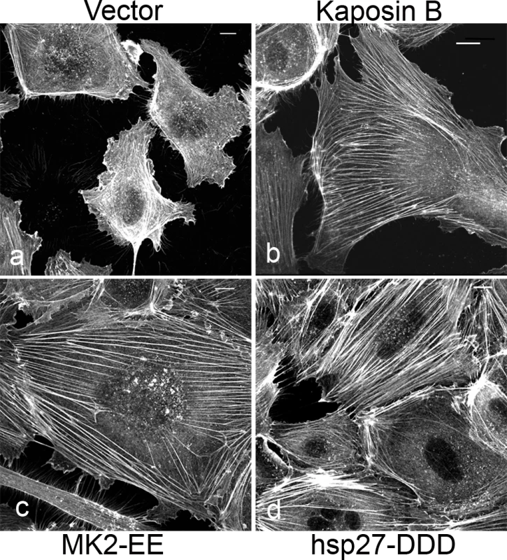 KapB promotes actin stress fiber formation in human umbilical vein endothelial cells.