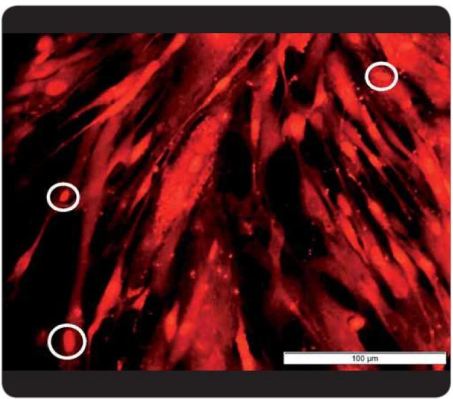 Fotografie fibroblastů (HFF) vystavených působení doxorubicinu (inkubace buněk s doxorubicinem o koncentraci 2 mg/ml po dobu 45 minut), pořízena za použití fluorescenčního mikroskopu při excitaci 520–550 nm a emisi 580 nm, 400krát zvětšeno. Jádra fibroblastů jsou vyznačena bílou barvou. Fluorescence byla pozorována pomocí fluorescenčního mikroskopu Olympus IX 71 (Japonsko).