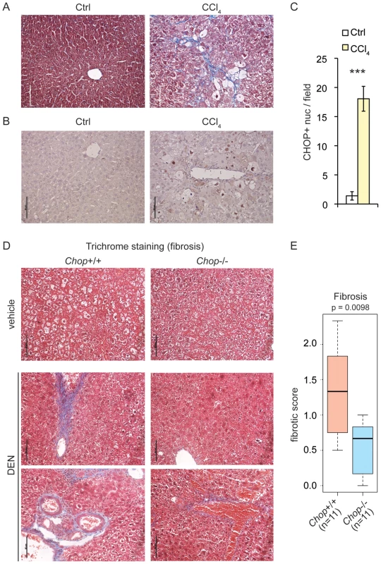 CHOP is induced by fibrotic insult and promotes fibrosis.