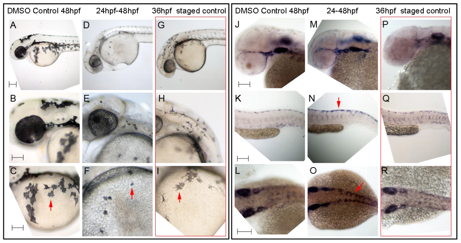 Hdac inhibition with Trichostatin A decreases melanocyte differentiation and prolongs <i>sox10</i> expression in neural crest cells.