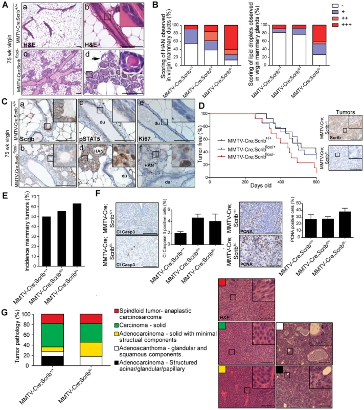 Scribble loss enhances mammary tumourigenesis.