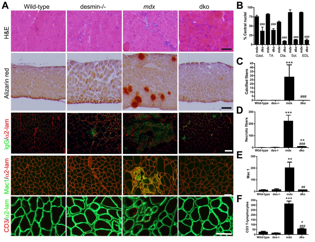 The dystrophic histopathology in <i>mdx<sup>4cv</sup></i> mice was profoundly improved by the absence of desmin.