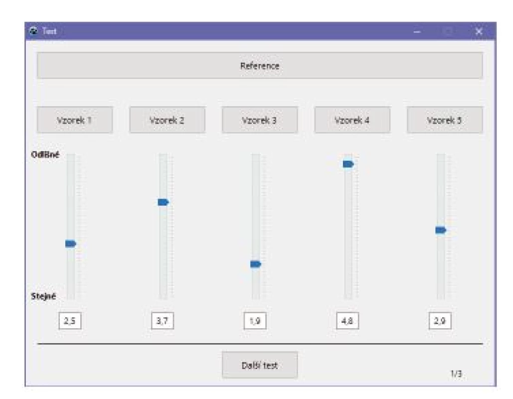 The graphical user interface.