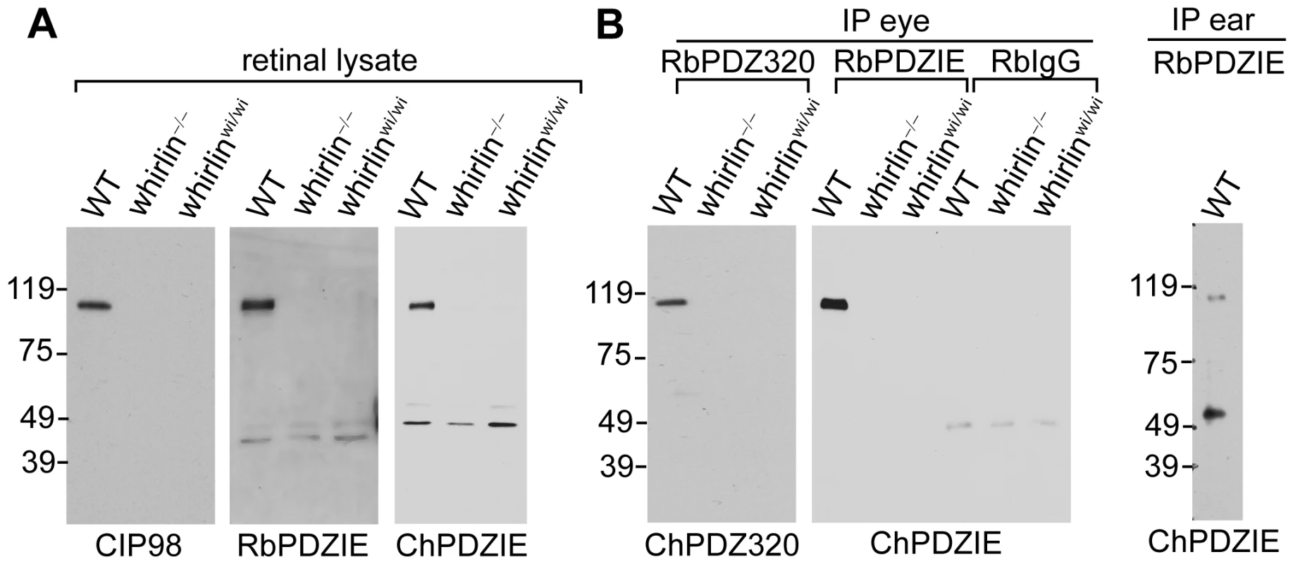 Whirlin expresses its long isoform in the retina.
