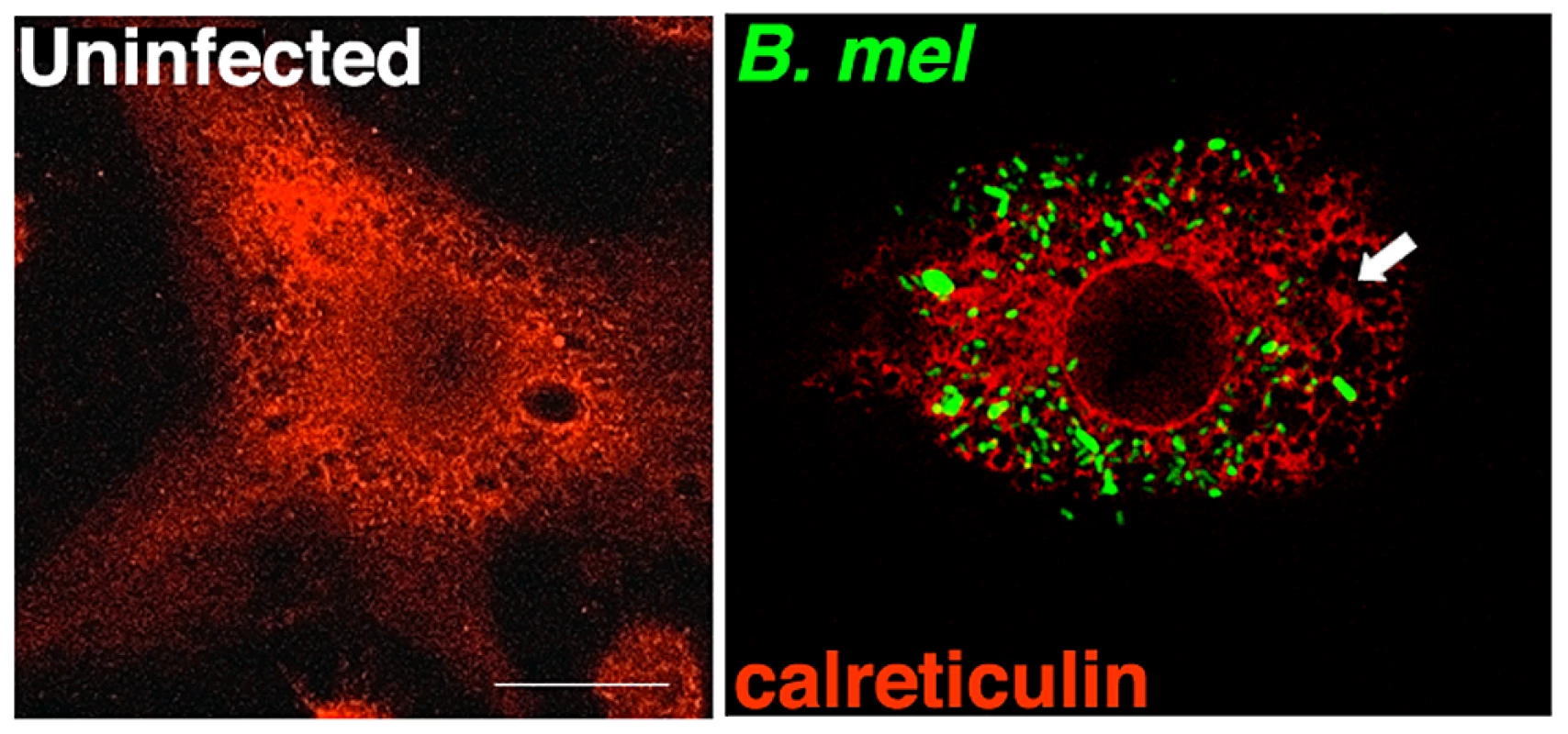 <i>Brucella</i> infection of macrophages induces ER structural reorganization.
