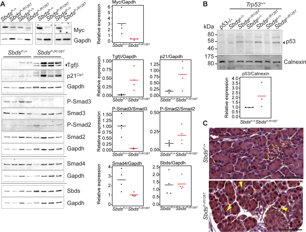 Tgfβ and p53 response in the SDS pancreas.