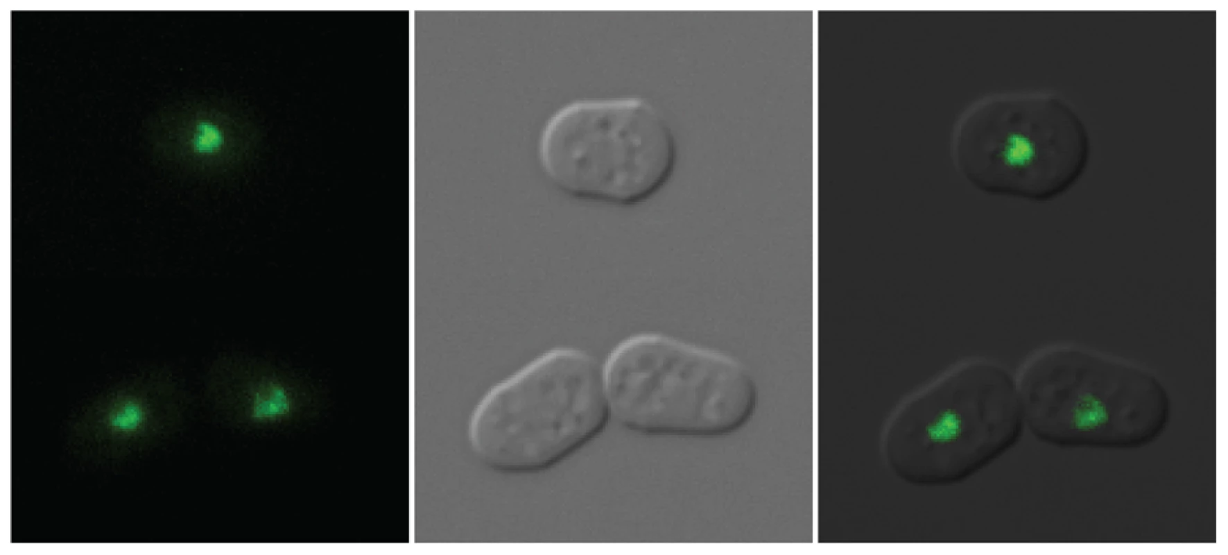 Localization of Clr5-GFP.