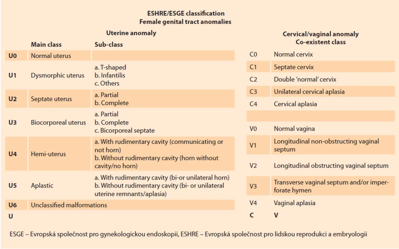 Klasifi kace vrozených vývojových vad ženského pohlavního systému dle ESHRE/ESGE [4]. Fig. 1. Classifi cation of congenital developmental defects of the female reproductive system according to ESHRE/ESGE [4].