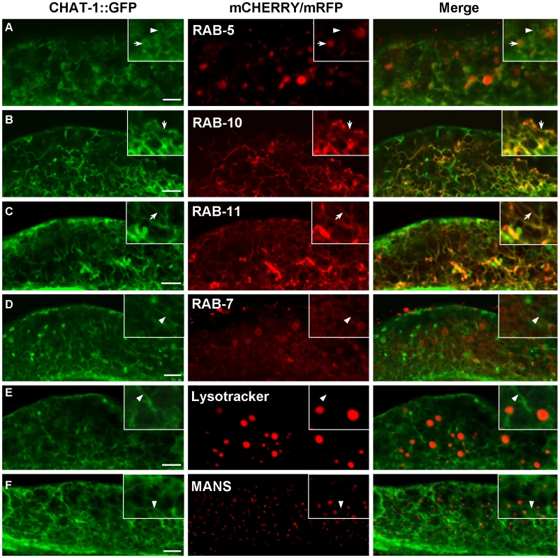 CHAT-1::GFP labels tubular structures in the intestine.