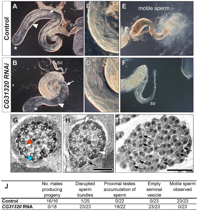 <i>CG31320</i> is required for sperm flagellar motility and male fertility.