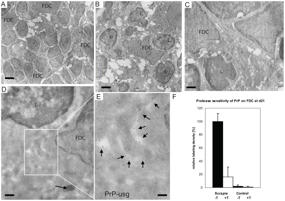 Increased PrP accumulation upon FDCs through the course of early prion disease.
