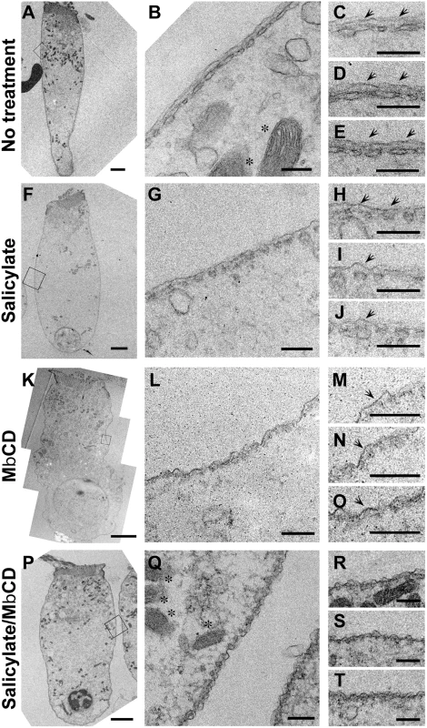 Ultra-structural analysis of the OHC lateral wall in isolated OHCs.