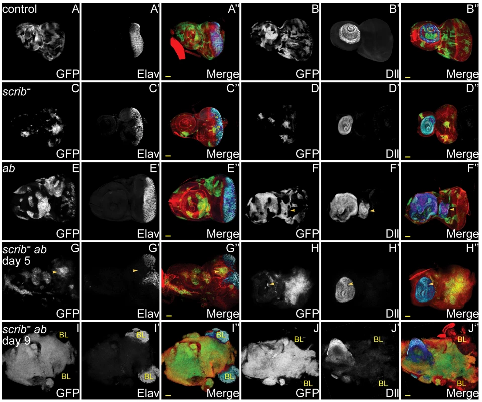 <i>ab</i> overexpression in <i>scrib</i> mutant clones promotes neoplastic overgrowth of eye/antennal epithelial tissue throughout an extended larval stage.