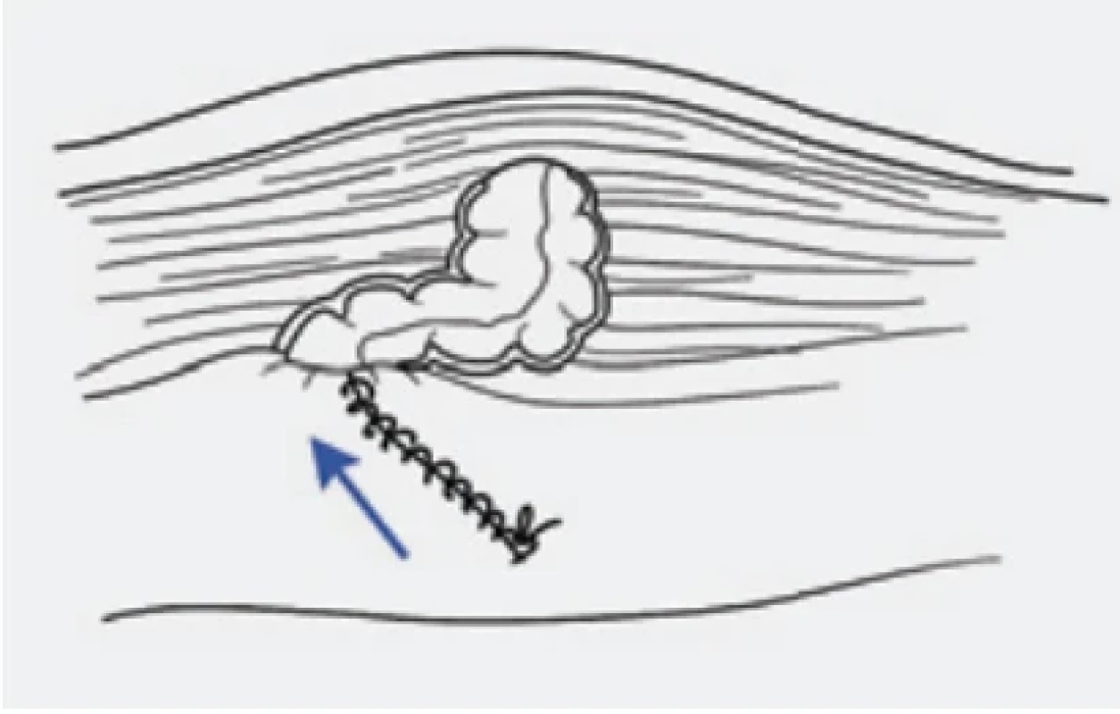 . / Fig. 9.