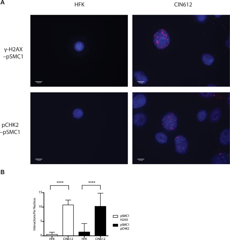 On-slide co-immunoprecipitations for pSMC1 in HFKs and HPV positive cells shows a direct interaction between pSMC1 and γ-H2AX as well as pSMC1 and pCHK2 in HPV positive cells but not HFKs.