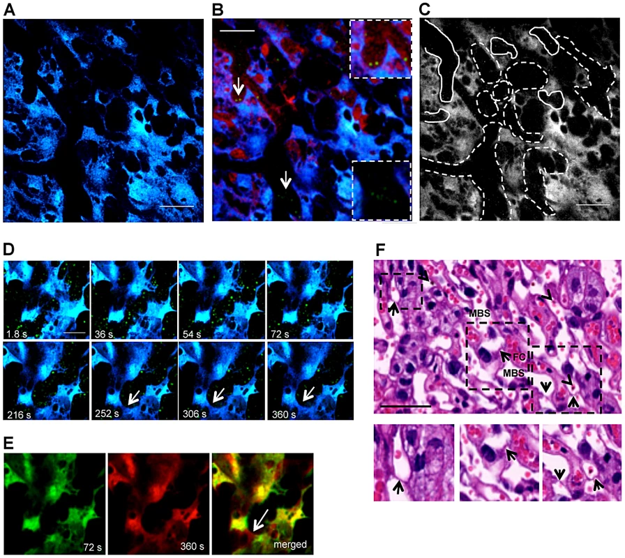 Blood flow rate in the labyrinth of infected placenta is conditioned by trophoblast conformational changes.
