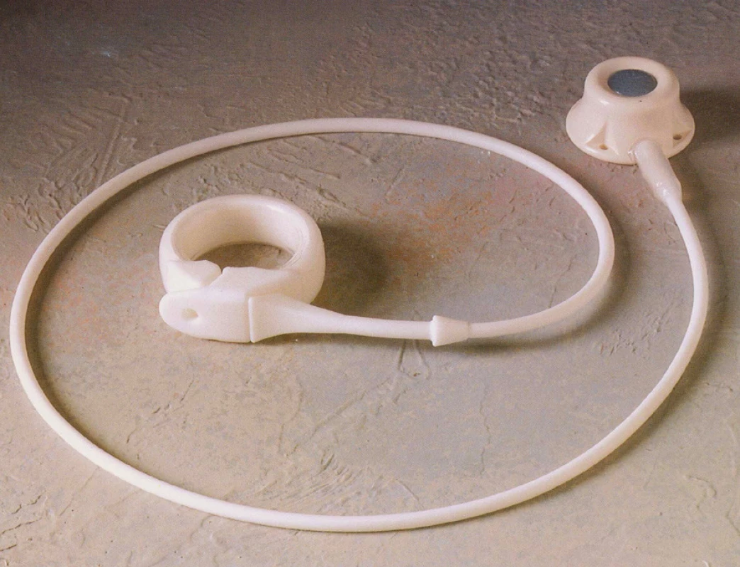 Lap-Band
Fig. 2. Lap-Band