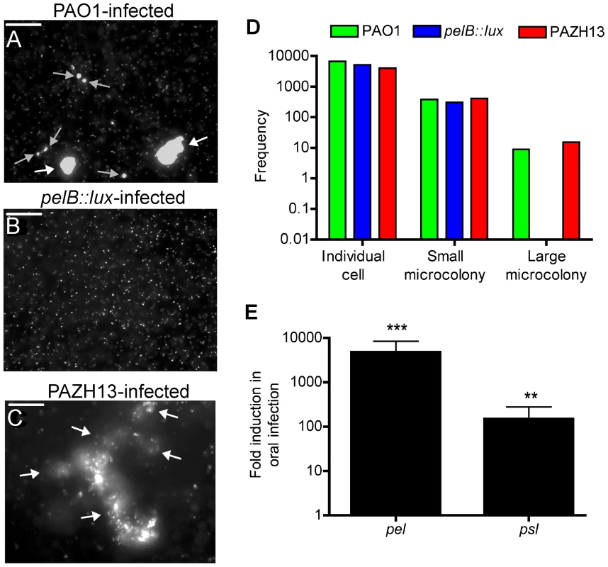 The role of Pel EPS during <i>in vivo</i> biofilm formation in <i>Drosophila.</i>