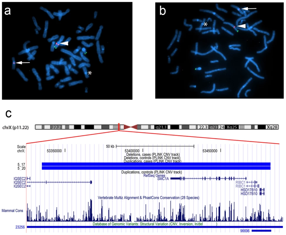 Karyotype der(9)ins(X;9)(p11.22;q12) in family 5.