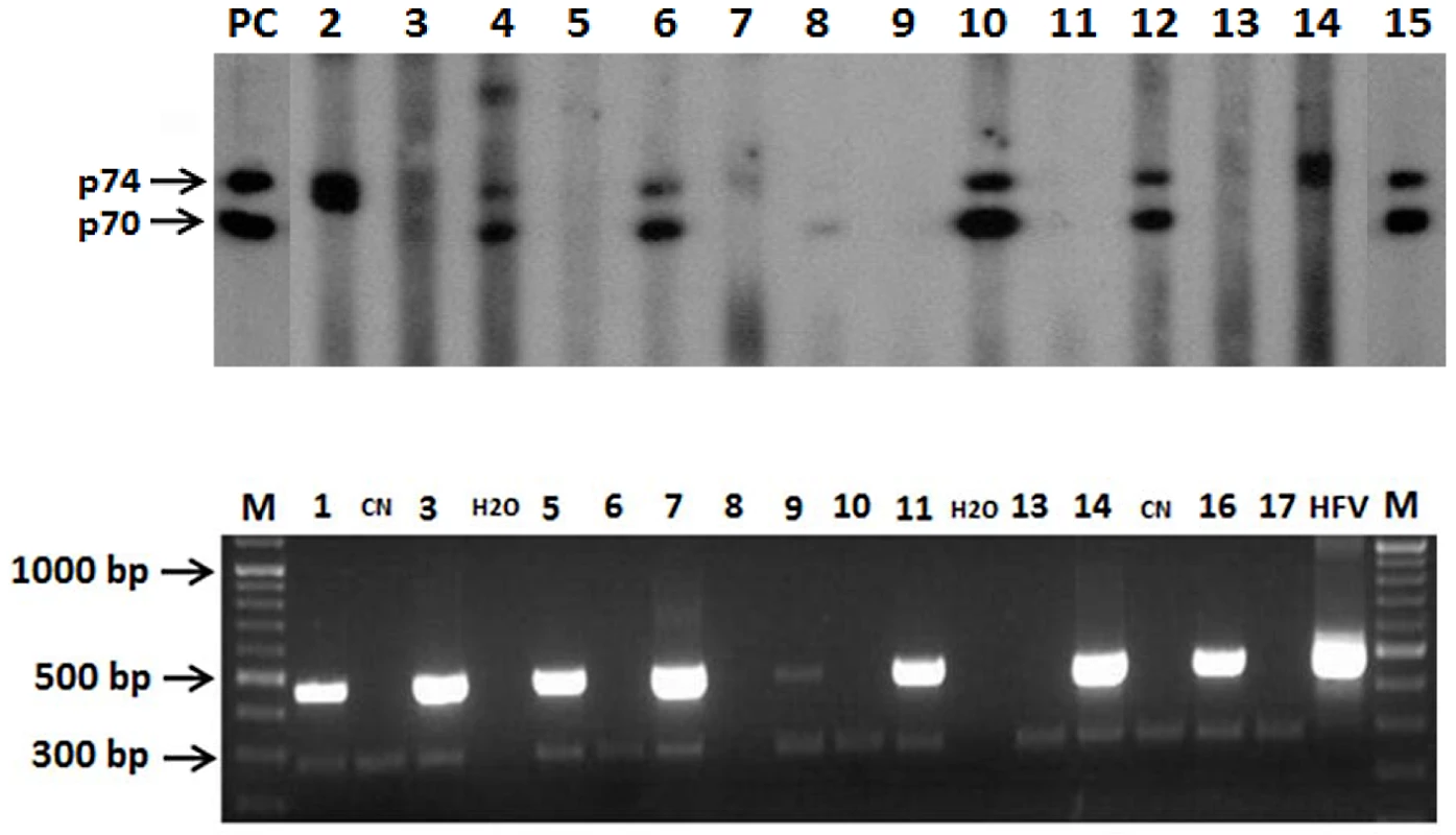 Serological and molecular results patterns for SFV detection.