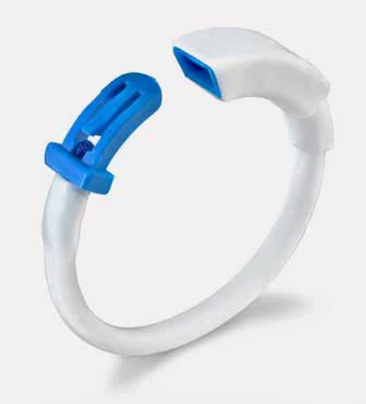 Fobi ring [13].
