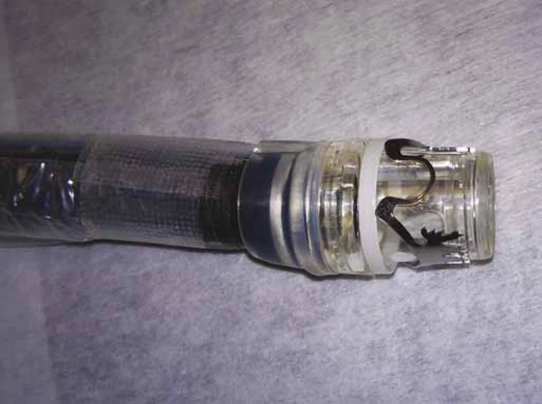 FTRD nasazený na konec standardního koloskopu.
Fig. 2. Full-thickness resection device mounted on the end of a standard coloscope.