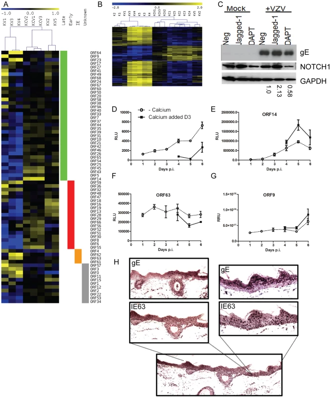 Altered VZV gene expression following keratinocyte differentiation.
