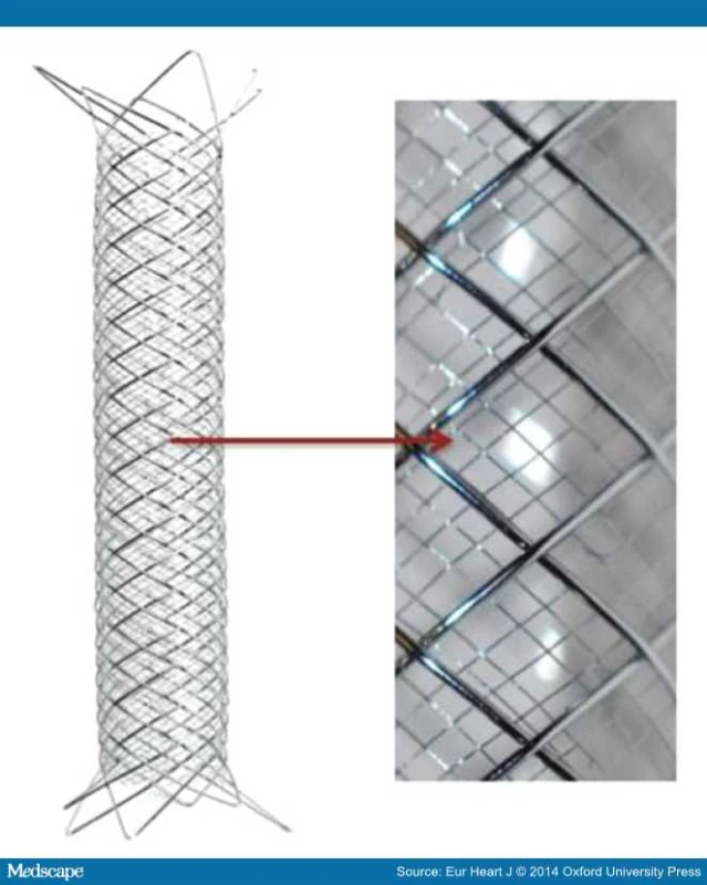 Karotický stent s dvojitým výpletem (Casper, MicroVention)