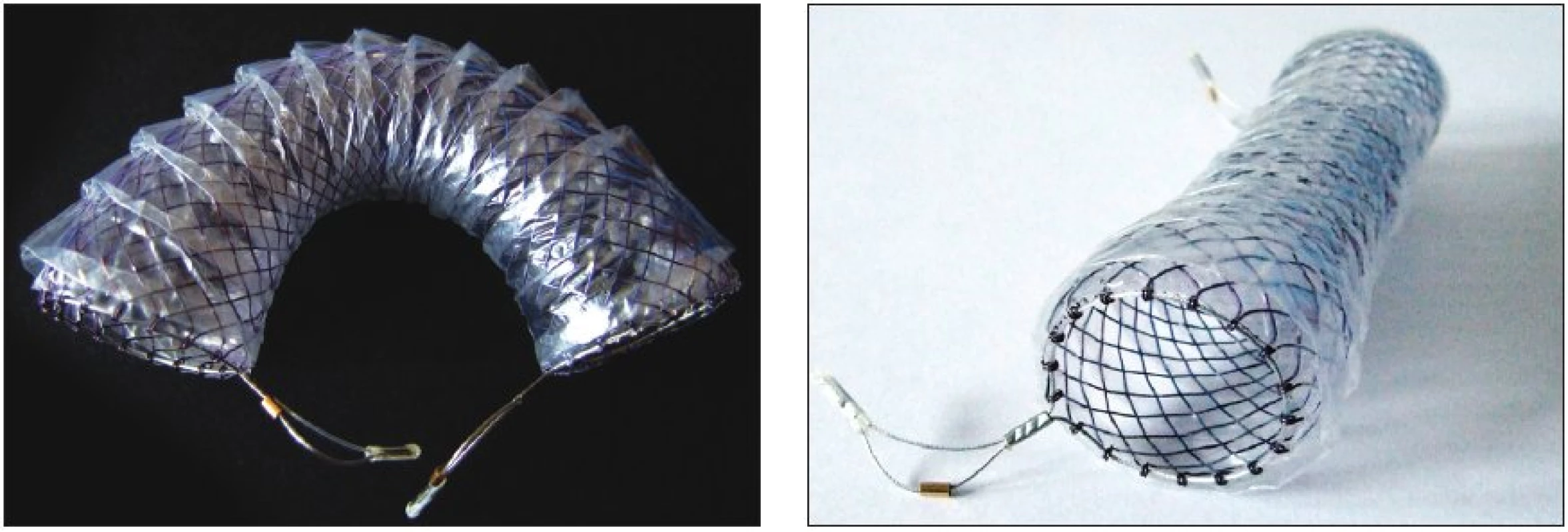 a 4. Flexella – Různé typy expandibilních metalických stentů ELLA
Fig. 3 and 4. Flexella – various types of ELLA expandable metallic stents