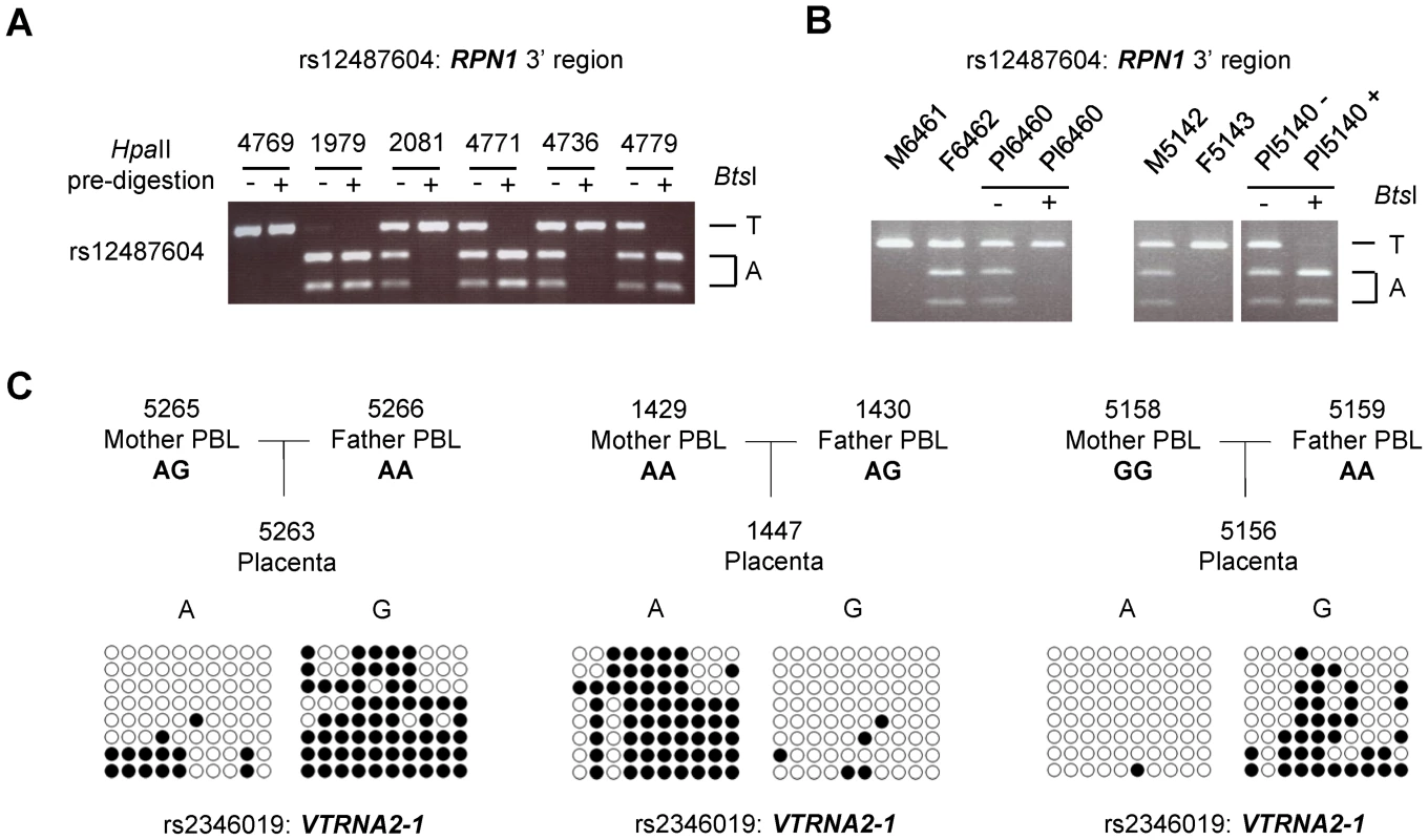 ASM downstream of the <i>RPN1</i> gene and in the <i>VTRNA2-1</i> gene is due to genomic imprinting with hypermethylation of the maternal allele.