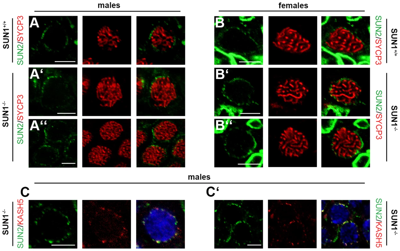 Meiotic telomere tethering by LINC complex components in the absence of SUN1.