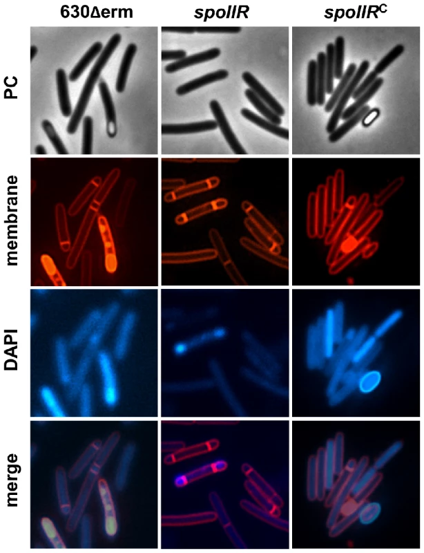 Morphological characterization of a <i>spoIIR</i> mutant.