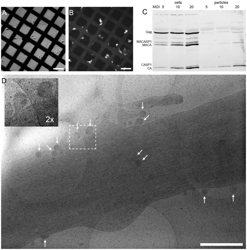 HIV-1 assembly sites imaged by cryo electron microscopy of intact human cells.