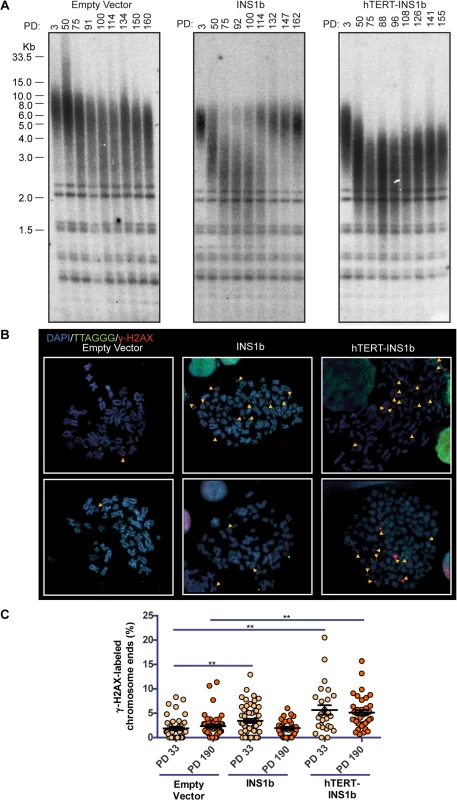INS1b overexpression results in shorter telomeres and increased telomeric DNA damage response.