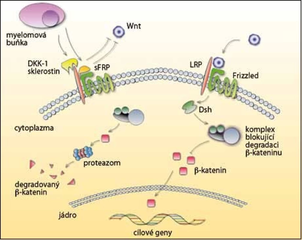 Dráha Wnt a její inhibitory v mnohočetném myelomu. 
V pravé části obrázku je zobrazena situace bez inhibitorů, kdy po navázání Wnt není β-katenin degradován. Přesunutím do jádra se spouští přepis genů pro normální vývoj osteoblastů. V levé části obrázku myelomová buňka produkuje inhibitory DKK-1 a sklerostin, které se vážou na receptor LRP, a sFRP, který blokuje vazbu na Frizzled receptor. Β-katenin není přenesen do jádra, ale degradován v proteazomu, a tak je potlačena  osteoblastogeneze.
