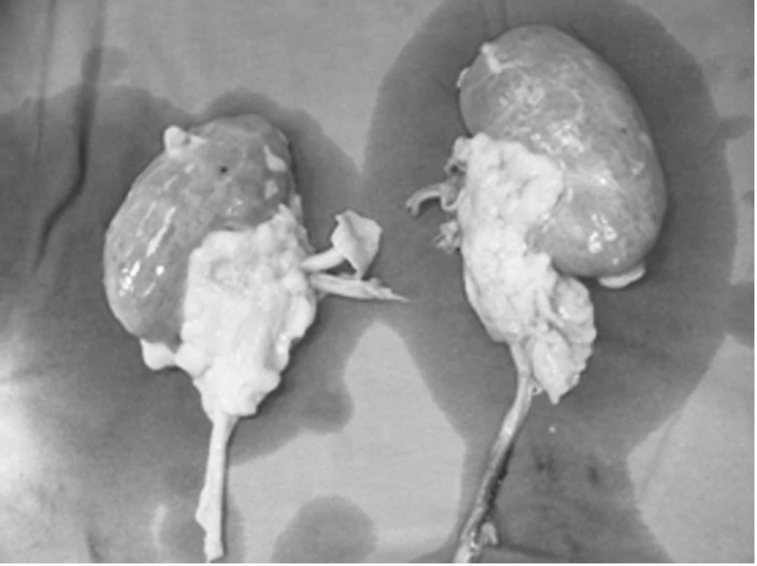 Odebrané ledvinné štěpy
Fig. 2. Collected kidney grafts