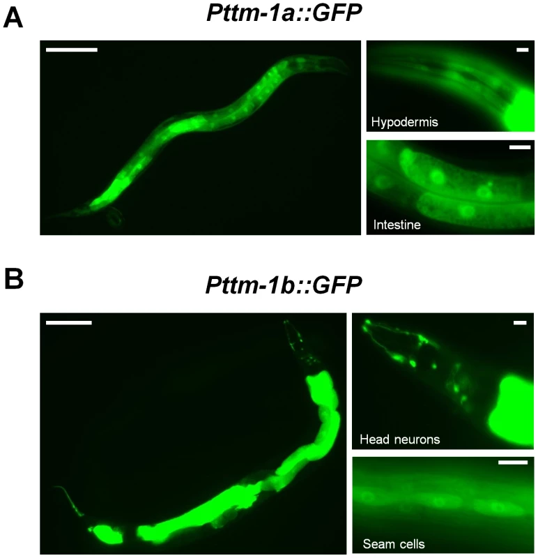 Expression pattern of <i>ttm-1</i>.