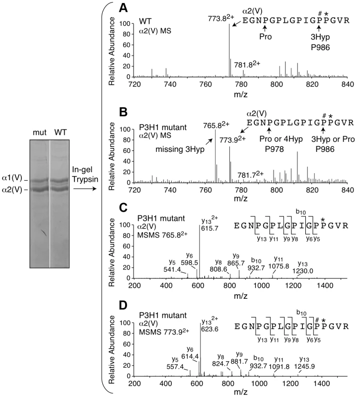 Prolyl 3-hydroxylation at Pro986 in the α2(V) collagen chain.