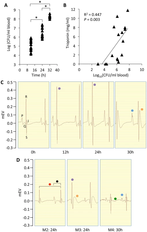 IPD is associated with alterations in cardiac electrophysiology and heart damage.
