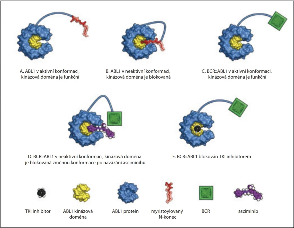 Zjednodušený mechanizmus účinku asciminibu. ABL1 protein se vyskytuje v aktivní (A) a v neaktivní podobě (B). V neaktivní podobě je myristoylovaný N-konec v interakci s takzvanou myristoylovou kapsou. Tento myristoylovaný N-konec ovšem chybí u chimérického fúzního proteinu BCR::ABL1, takže ABL1 je v aktivní konformaci (C). Tuto aktivní konformaci může změnit asciminib, který se váže do myristoylové kapsy (D). Blokace ABL1 pomocí TKI (E). 
