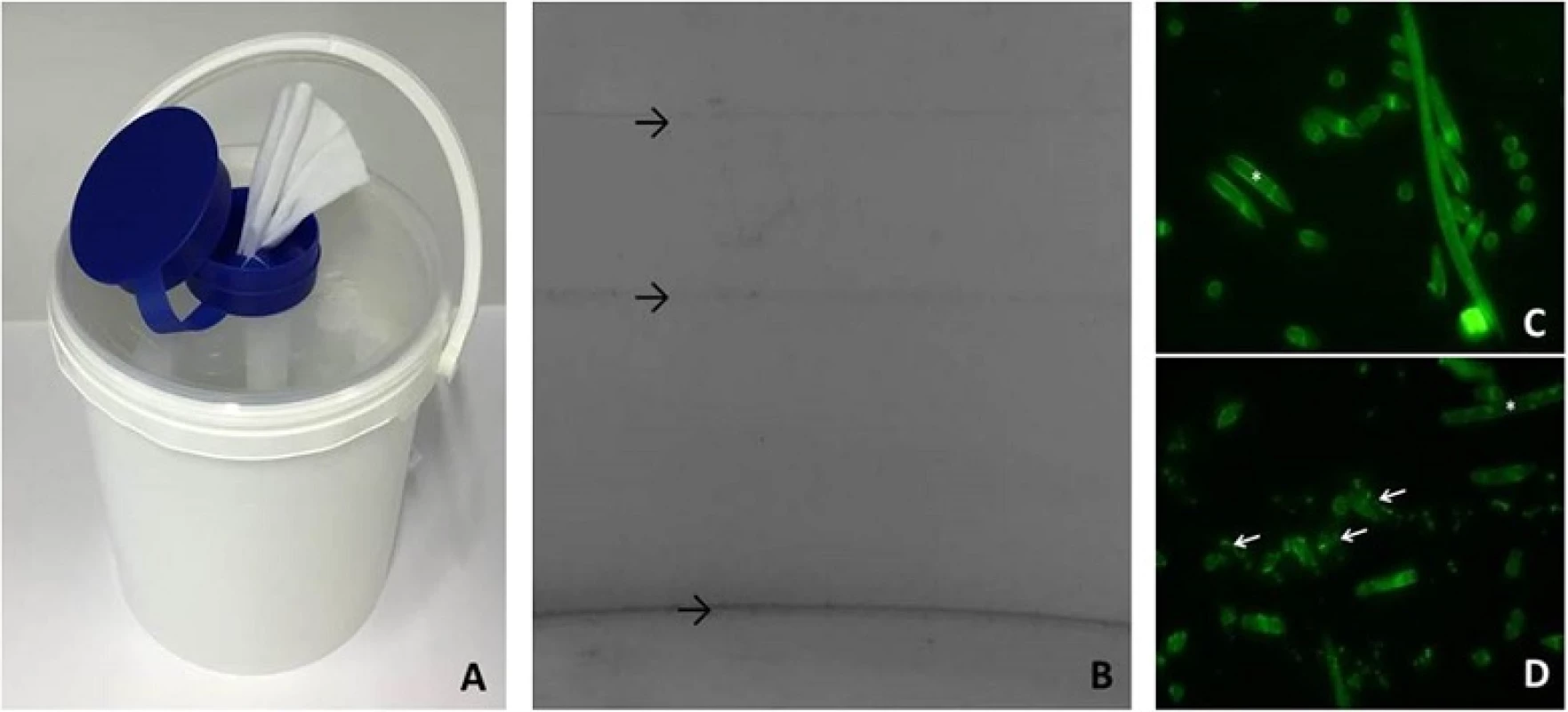 Pictures of dispensers and biofilm stains. a: a tissue dispenser bucket. b: AX biofilm on wall and bottom of dispenser buckets stained with crystalviolet; black arrows: increased biofilm formation on former liquid levels (upper arrows) and at the bottom of the bucket (lower arrow). c: acridine orange stained tissue sample of a newly assembled dispenser d: AX biofilm detected by acridine orange staining on tissues collected from a dispenser 5 weeks after reprocessing (white arrows: biofilm; * tissue fiber; 200× magnification)