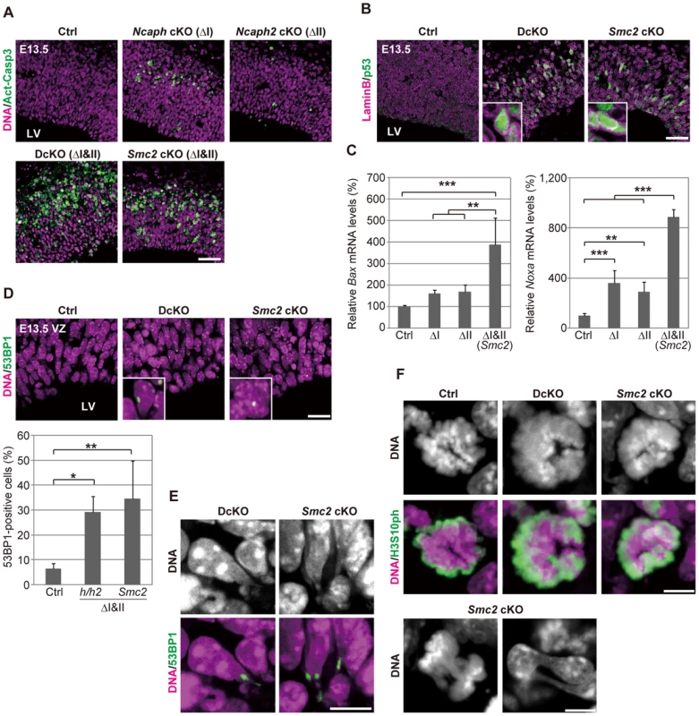 Defective chromosome segregation leads to DNA damage-induced apoptosis in NSCs depleted of both condensins.