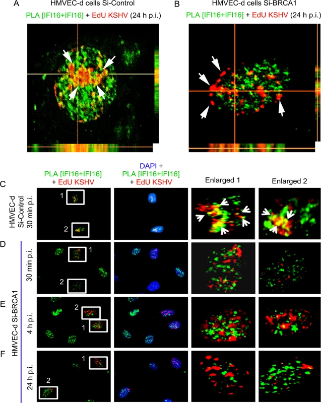 PLA analysis demonstrating abrogation of KSHV genome recognition by IFI16 in the absence of BRCA1 during <i>de novo</i> infection.