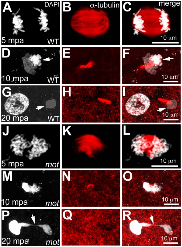 <i>motley</i> mutant eggs fail to complete meiosis II.